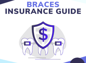 Can insurance cover braces - Spread Fun & Happiness